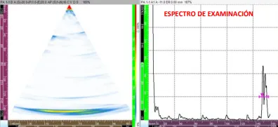 Ultrasonido Phase Array de Cigüeñal — imagen 2